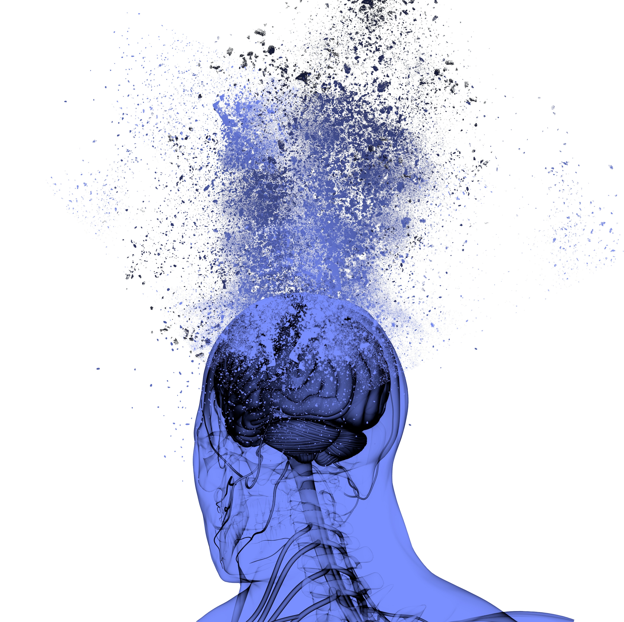 Deze neuroloog kreeg zelf alzheimer. ‘Als je vroeg genoeg begint, kun je de ziekte wel afremmen